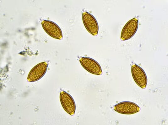 Parasitic Infections