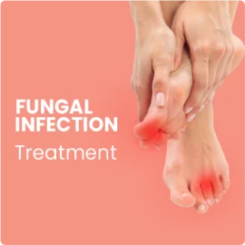 Fungal Infection Treatment