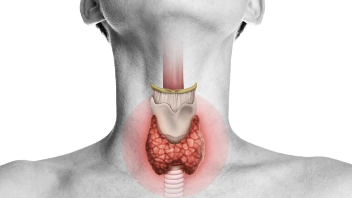 Cobblestone Throat