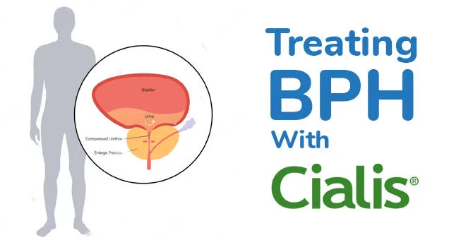 Tadalafil bph cialis