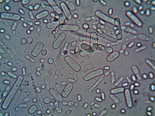 Microorganisms viewed under a microscope representing bacterial infection