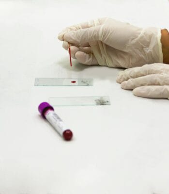 Laboratory blood test tubes for TRT monitoring