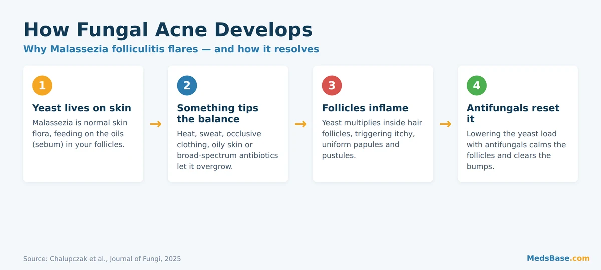 Diagram showing how Malassezia yeast overgrowth causes fungal acne in follicles