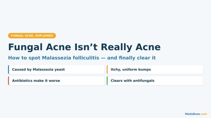 Fungal acne signs and antifungal treatment overview infographic
