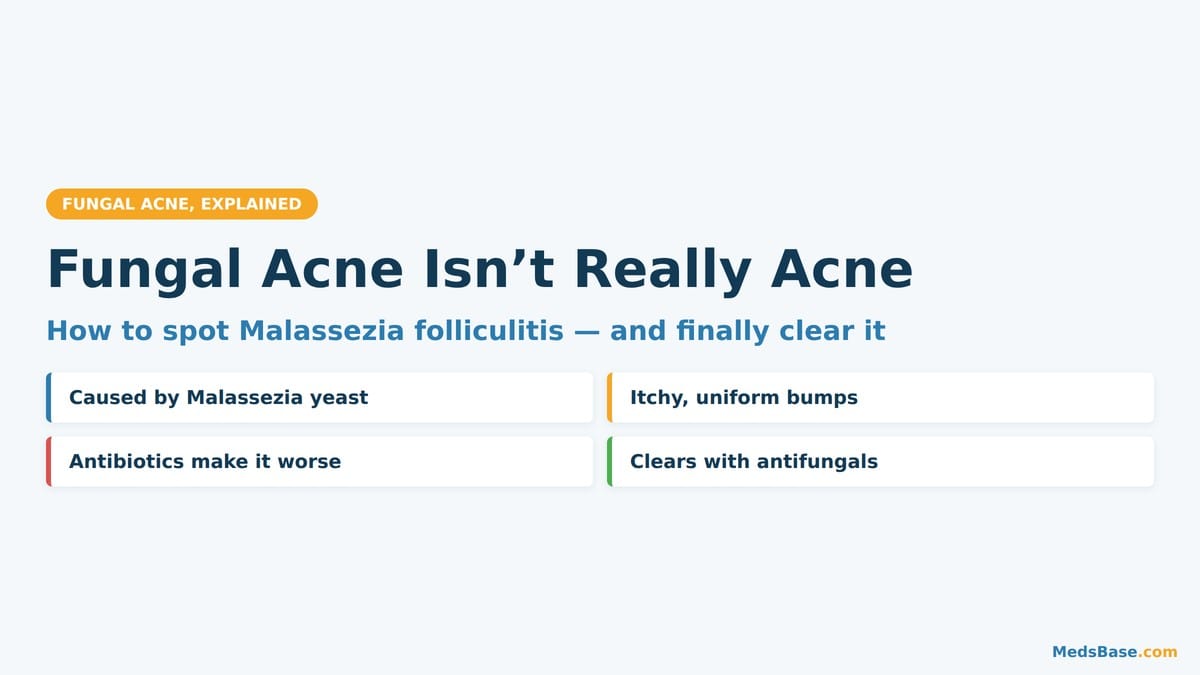 Fungal acne signs and antifungal treatment overview infographic