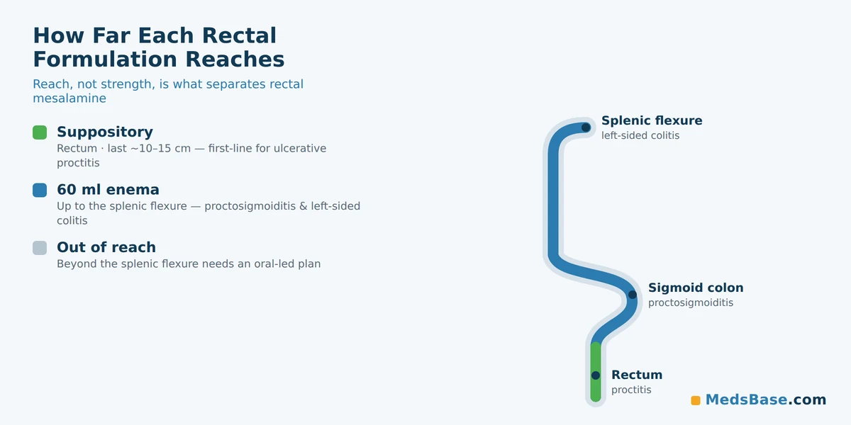 Diagram showing how far a mesalamine suppository and a mesalamine enema reach in the colon