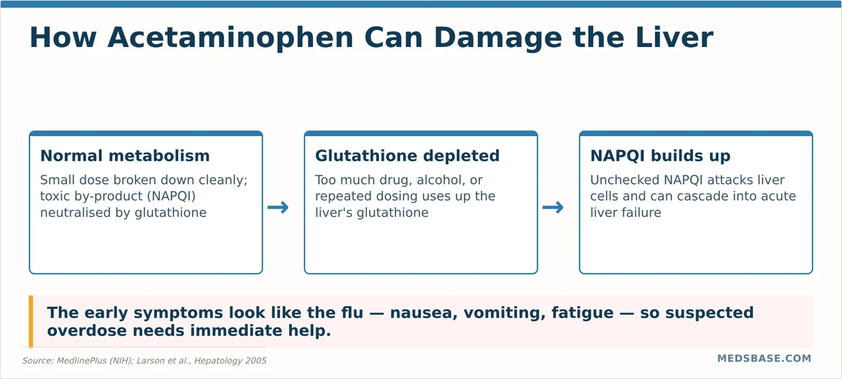 Acetaminophen liver toxicity NAPQI mechanism — from therapeutic metabolism to glutathione depletion