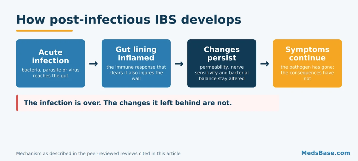 How post-infectious IBS develops from acute gastroenteritis to lasting gut symptoms in four stages