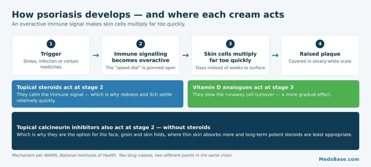 How psoriasis develops, from immune trigger to raised plaque with silvery scale