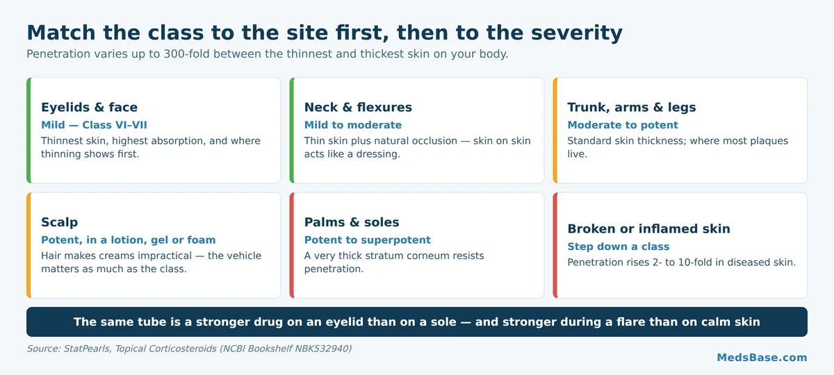 Which topical steroid potency class suits each body site from eyelids to soles