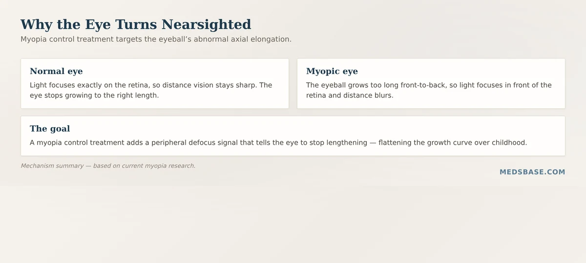 Mechanism of myopia control treatment — axial elongation makes light focus in front of the retina