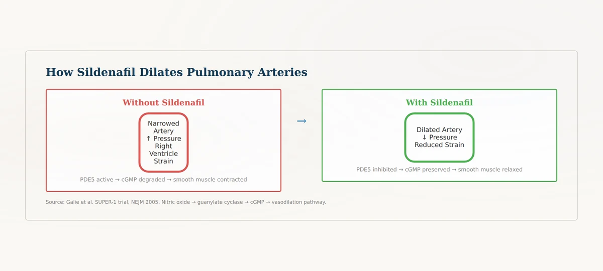 Sildenafil mechanism of action — PDE5 inhibition leading to pulmonary artery vasodilation