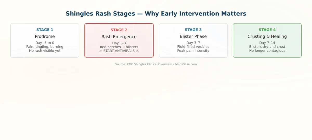 shingles rash stages from prodrome to healing — early antiviral intervention starts at stage 2